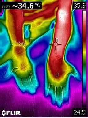 Immagine termografica di avambracci e mani ripresa con termocamera