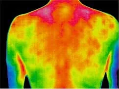 Mappa termografica della schiena
